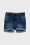 Дитячі шорти United Colors of Benetton колір блакитний (2408104)