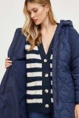 Куртка Answear Lab жіноча колір синій перехідна (3677057)