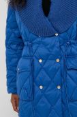 Пухова куртка Silvian Heach жіноча перехідна oversize колір блакитний